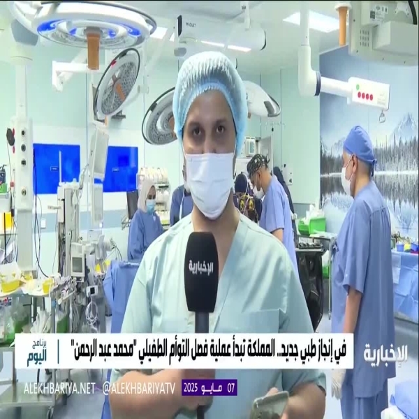 التوأم الطفيلي المصري "محمد