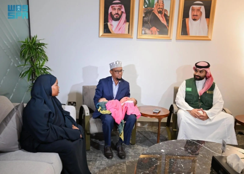 توأم صومالي ملتصق "رحمة