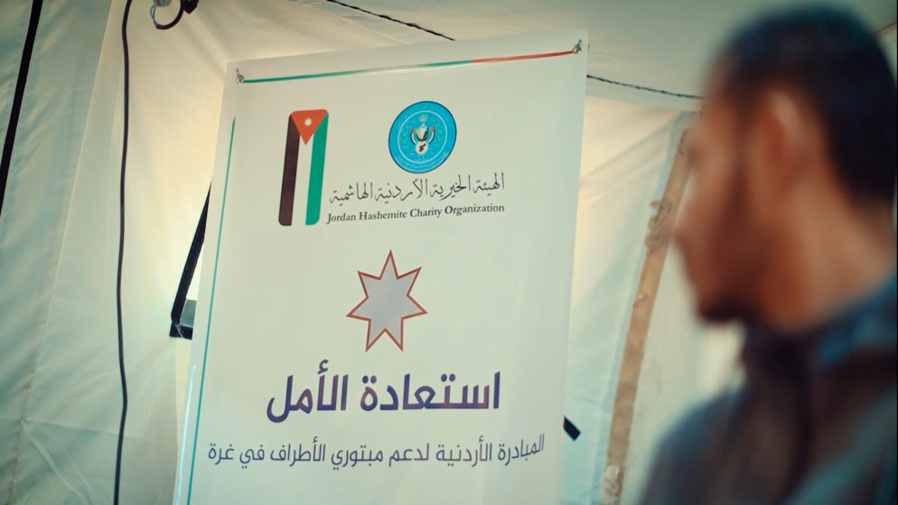 توفير 477 طرفًا صناعيا