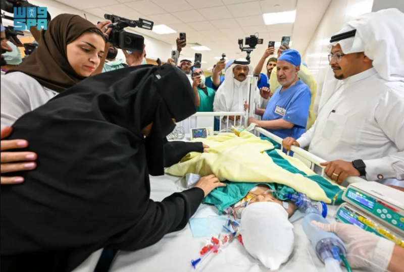 تكللت جهود الأطباء بنجاح فصل التوأم الملتصق السعودي “يارا ولارا” بعد عملية جراحية دقيقة استغرقت 12 ساعة ونصف